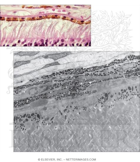 Light Micrograph of Part of the Retina and Choroid With Electron Micrograph of the Sclera, Choroid, and Outer Part of the Neural Retina