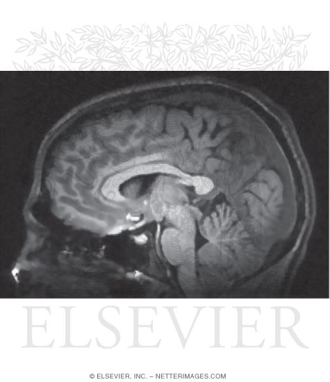 Magnetic Resonance Image of the Brain and Brainstem In the Midsagittal Plane