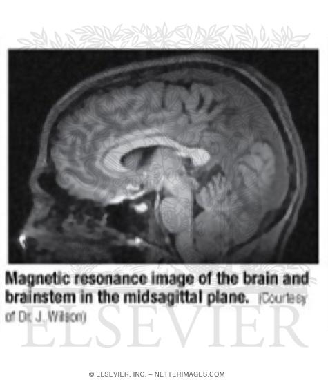 Magnetic Resonance Image of the Brain and Brainstem In the Midsagittal Plane