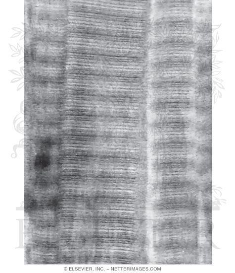 Electron Micrograph of Type I Collagen Fibrils at High Magnification