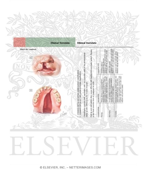 Watermarked preview of labeled image: Cleft Lip and Palate