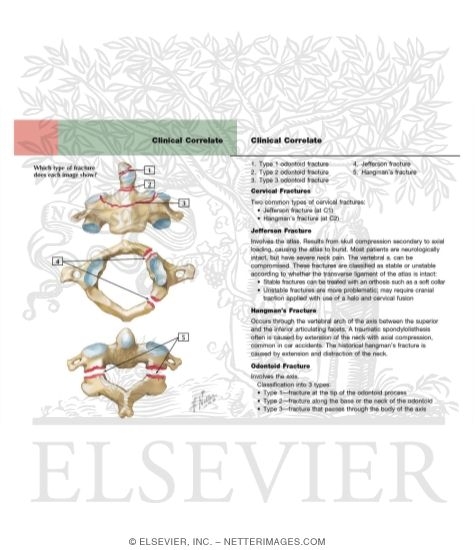 Watermarked preview of labeled image: Cervical Fractures