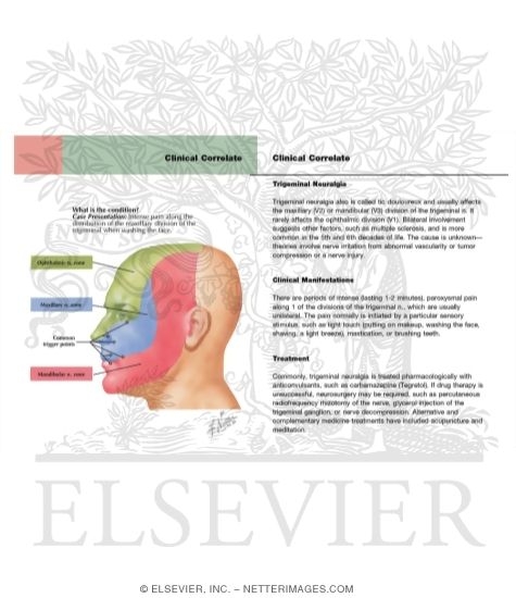 Trigeminal Neuralgia