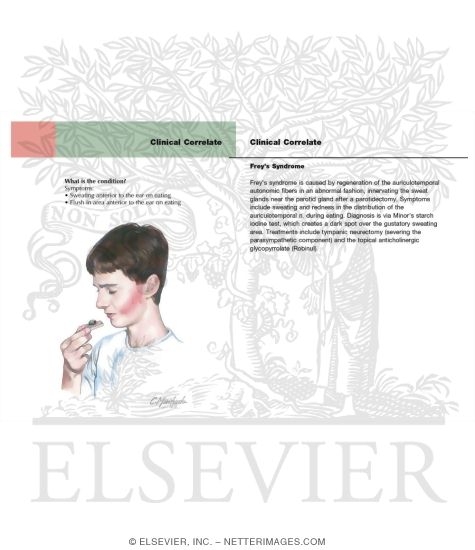 Watermarked preview of labeled image: Frey's Syndrome