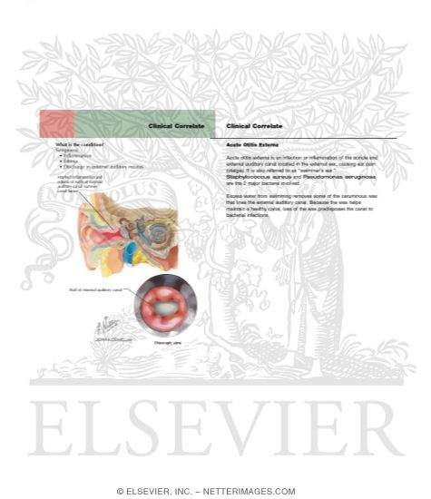 Acute Otitis Externa