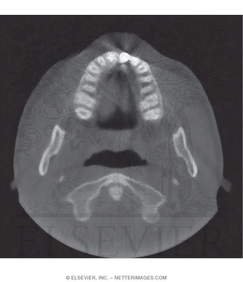 CT Image: Axial View
