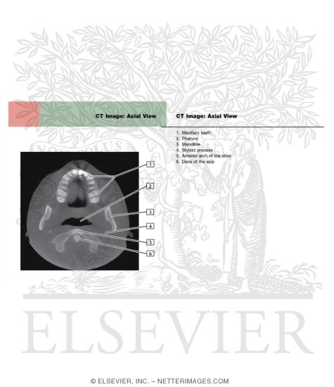 Watermarked preview of labeled image: CT Image: Axial View