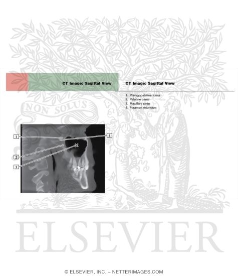 CT Image: Sagittal View