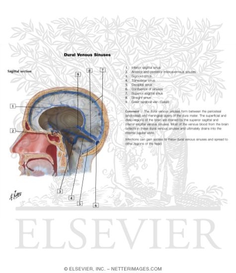 Watermarked preview of labeled image: Dural Venous Sinuses