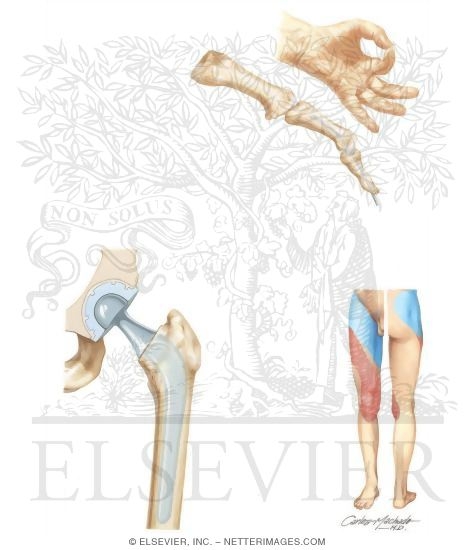 Watermarked preview of unlabeled image: Joint Malalignment and Instability