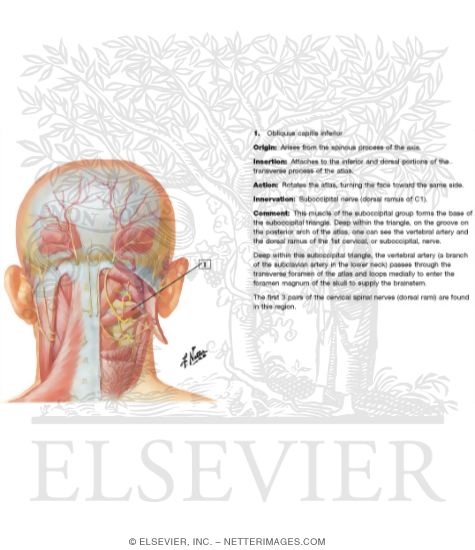 Watermarked preview of labeled image: Suboccipital Triangle