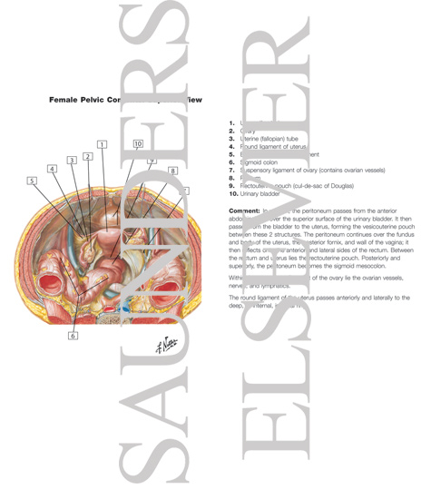 Watermarked preview of labeled image: Pelvic Contents: Female