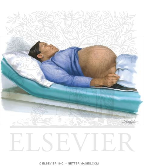 Watermarked preview of unlabeled image: Pregnant Woman Lying Down