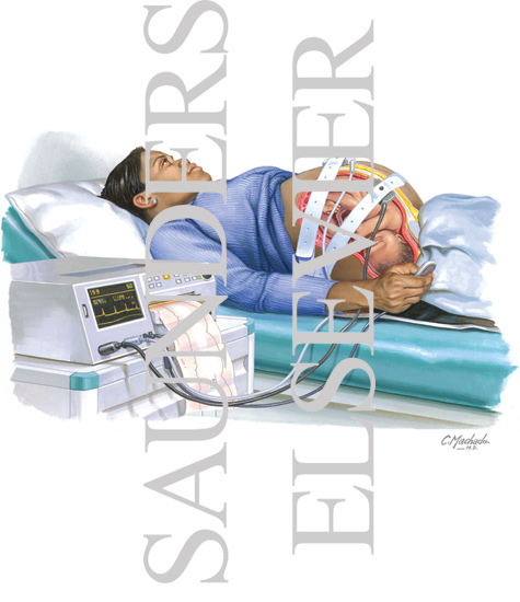 Watermarked preview of unlabeled image: Pregnant Woman Lying Down - Showing Fetus