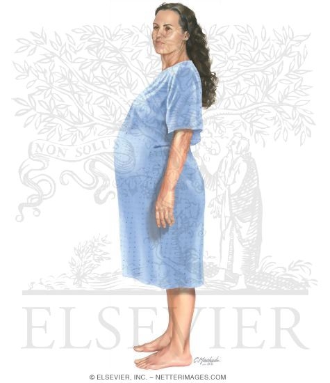 Pregnant Woman Standing