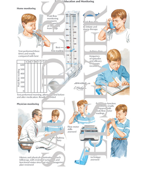 Watermarked preview of labeled image: Patient Education and Monitoring