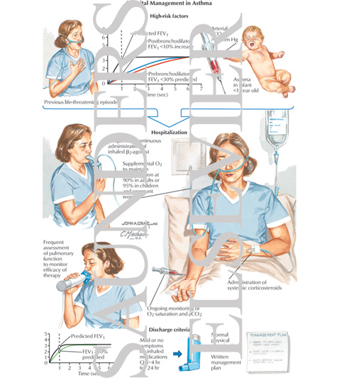 Watermarked preview of labeled image: Hospital Management in Asthma