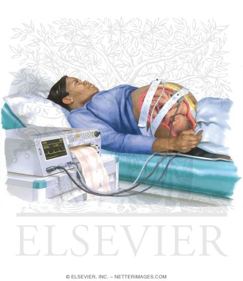 Nonstress Testing In Pregnancy