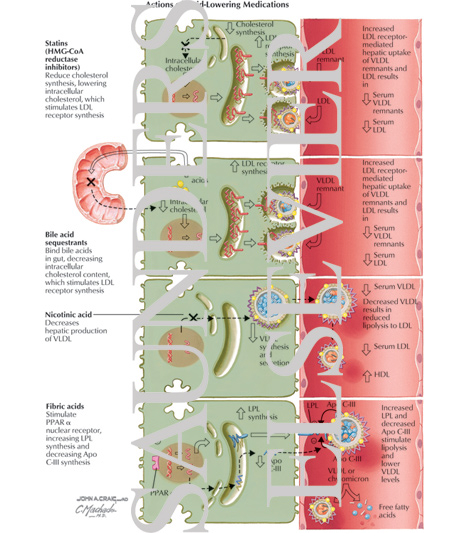 Watermarked preview of labeled image: Actions of Lipid-Lowering Medications