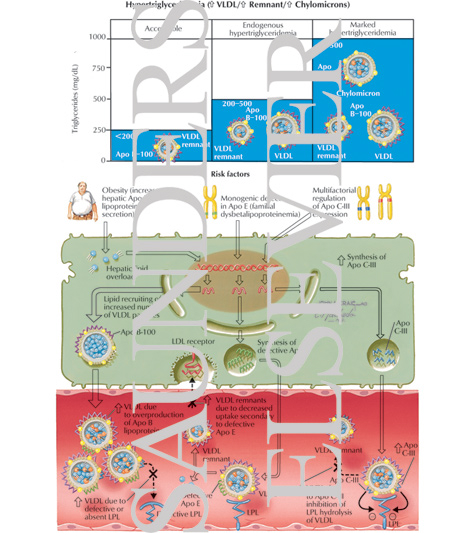 Watermarked preview of labeled image: Hypertriglyceridemia
