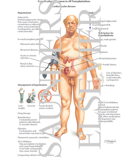 Watermarked preview of labeled image: Complications Common to All Transplantations