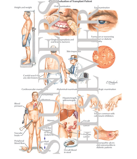 Watermarked preview of labeled image: Clinical Evaluation of Transplant Patient