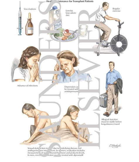 Watermarked preview of labeled image: Health Maintenance for Transplant Patients