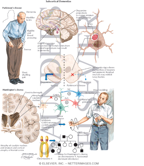 Subcortical Dementias