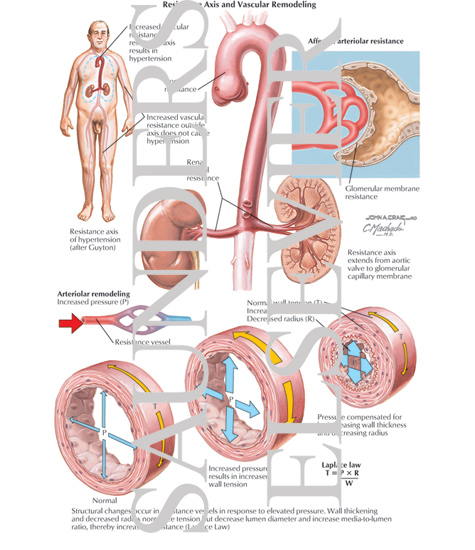 Watermarked preview of labeled image: Resistance Axis and Vascular Remodeling