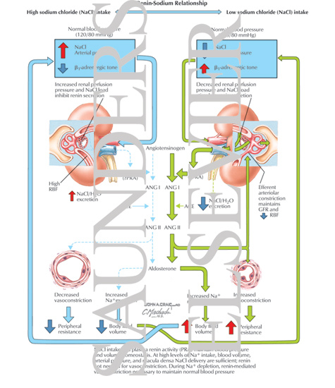 Watermarked preview of labeled image: Renin-Sodium Relationship