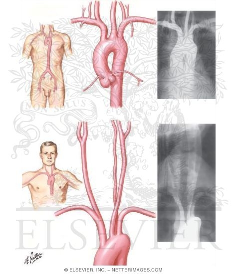 Watermarked preview of unlabeled image: Thoracic Aortography