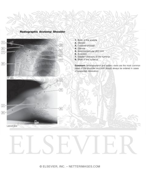 Watermarked preview of unlabeled image: Radiographic Anatomy: Shoulder