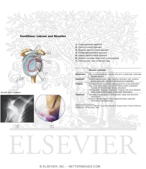 Watermarked preview of labeled image: Shoulder: Glenohumeral Joint