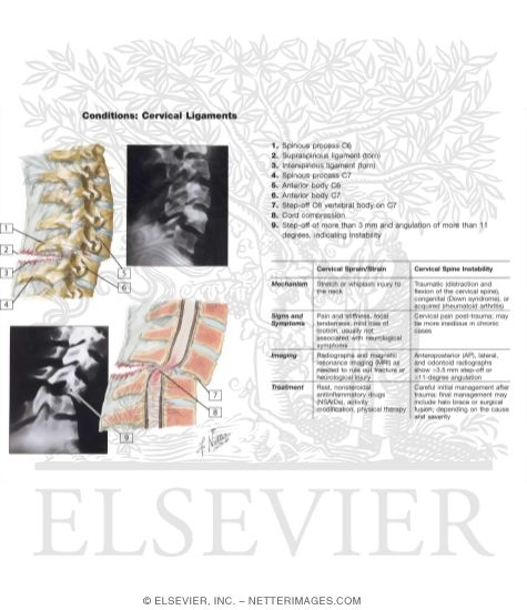 Watermarked preview of labeled image: Dislocations of Cervical Spine