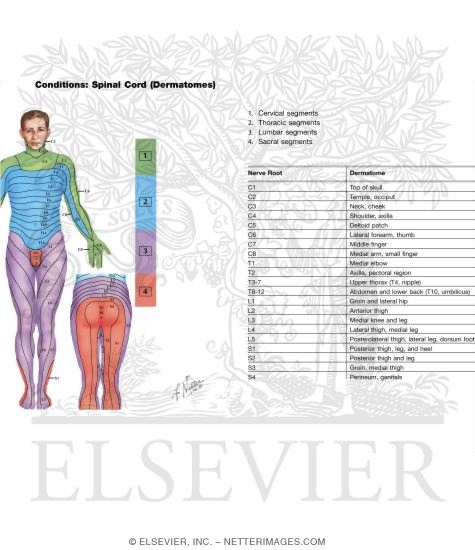 Watermarked preview of labeled image: Sensory Impairment Related to Level of Spinal Cord Injury