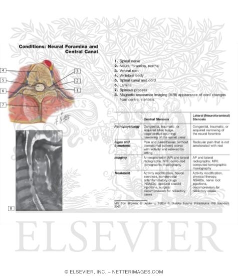 Watermarked preview of labeled image: Spinal Nerve Origin: Cross Sections 
Exit of Spinal Nerves
Spinal Nerves