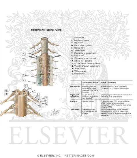 Watermarked preview of labeled image: Spinal Membranes and Nerve Roots