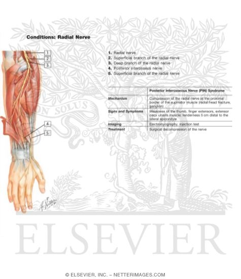 Radial Nerve in Forearm