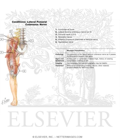 Watermarked preview of labeled image: Femoral Nerve and Lateral Femoral Cutaneous Nerves