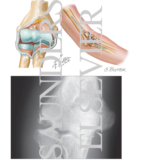 Watermarked preview of unlabeled image: Articular Cartilage