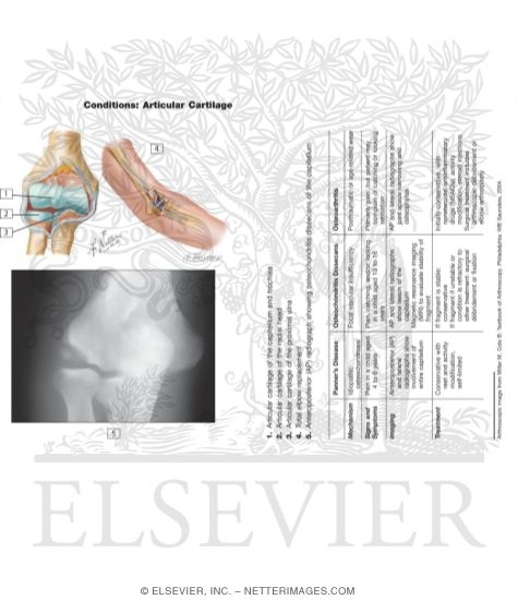 Articular Cartilage