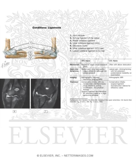 Watermarked preview of unlabeled image: Ligaments of the Elbow