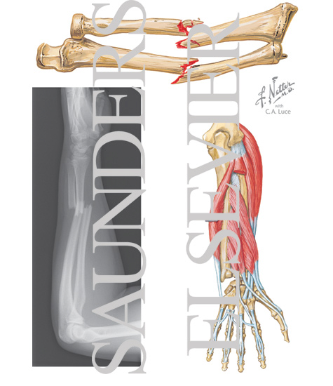 Forearm, Radius, and Ulna