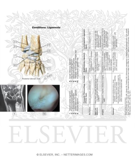Watermarked preview of labeled image: Ligaments of the Wrist