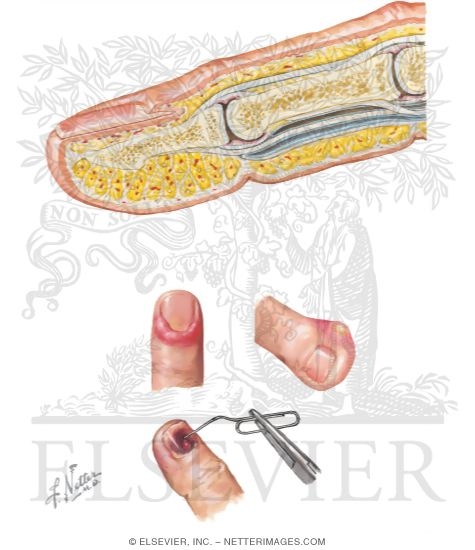 Watermarked preview of unlabeled image: Conditions of the Fingertip