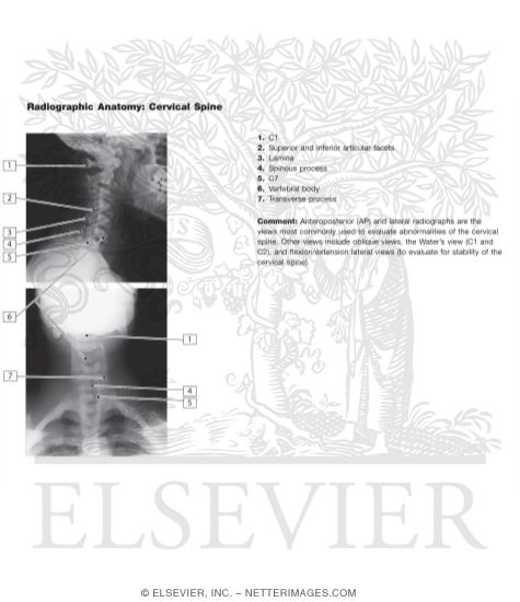 Watermarked preview of unlabeled image: Radiographic Anatomy of the Cervical Spine
