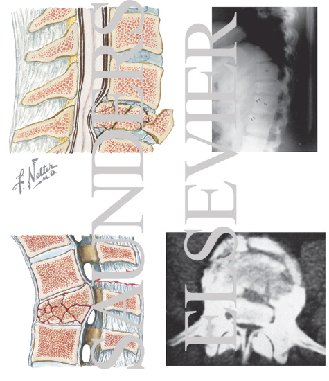 Watermarked preview of unlabeled image: Vertebral Bodies