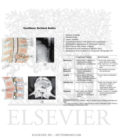 Watermarked preview of unlabeled image: Vertebral Bodies
