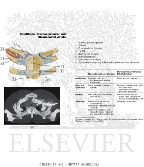 Clavicle and Sternoclavicular Joint Right Clavicle and Sternoclavicular