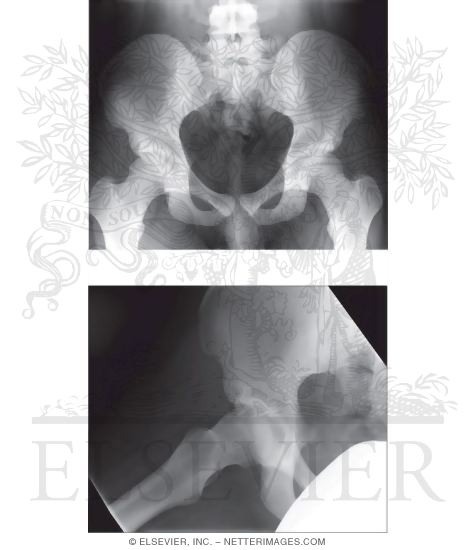 Radiographic Anatomy of the Pelvis and Hip